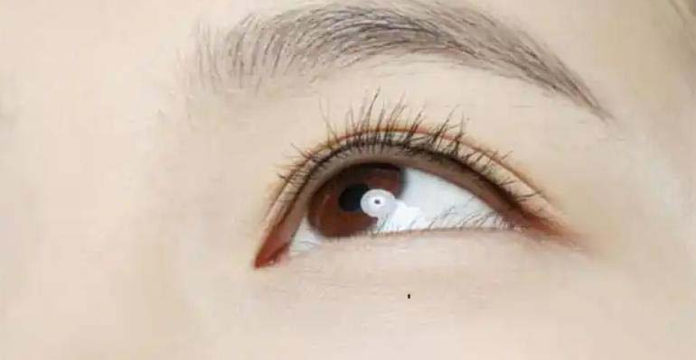 对运势不好的痣有哪些？