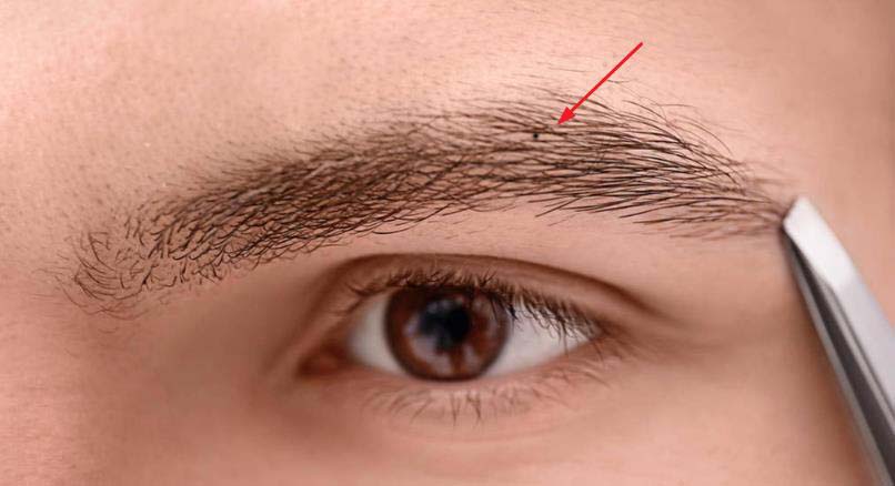 男人身上哪些是旺妻的痣相