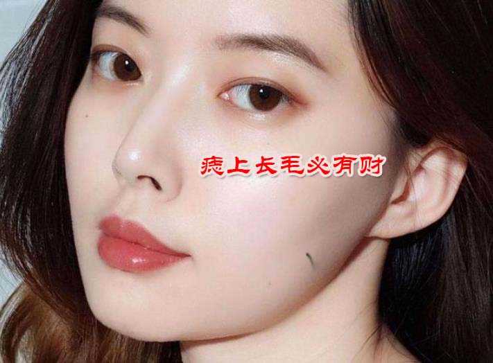痣上长毛代表什么？